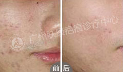 ���ݷ���Ƥ����ҽԺ