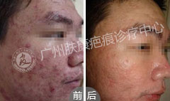 ���ݷ���Ƥ����ҽԺ