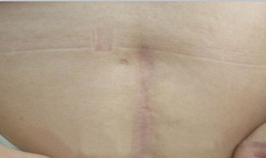 ���ݷ���Ƥ����ҽԺ