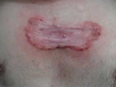 ���ݷ���Ƥ����ҽԺ