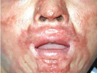 ���ݷ���Ƥ����ҽԺ