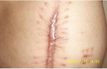 ���ݷ���Ƥ����ҽԺ