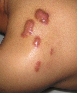 ���ݷ���Ƥ����ҽԺ