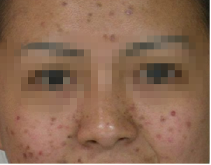 ���ݷ���Ƥ����ҽԺ