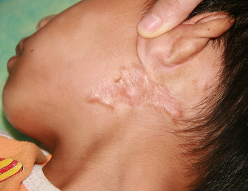 ���ݷ���Ƥ����ҽԺ