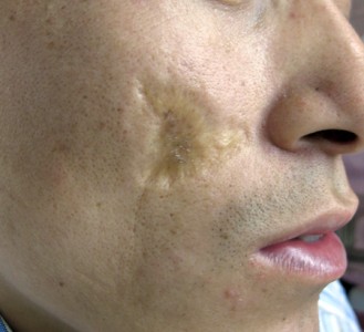 ���ݷ���Ƥ����ҽԺ