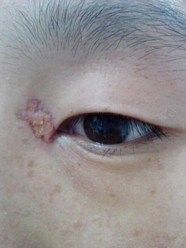 ���ݷ���Ƥ����ҽԺ