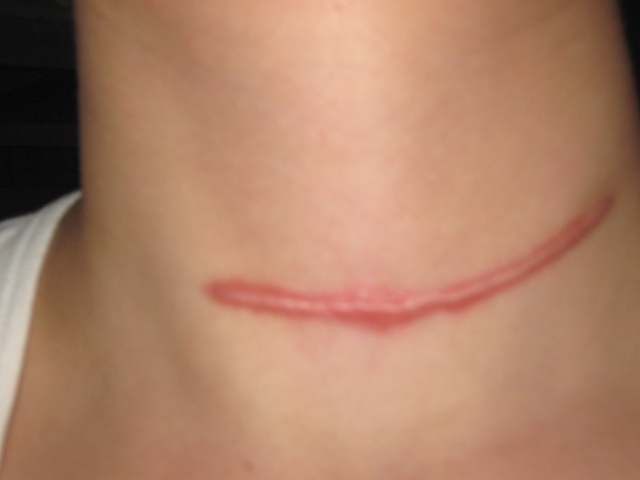 ���ݷ���Ƥ����ҽԺ