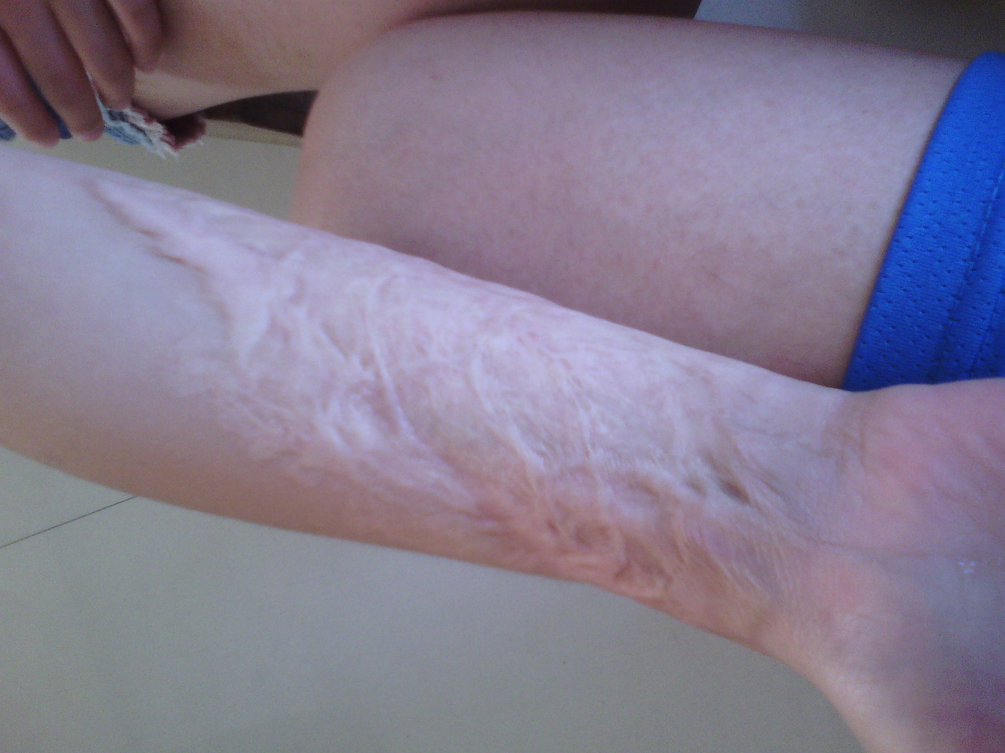 ���ݷ���Ƥ����ҽԺ