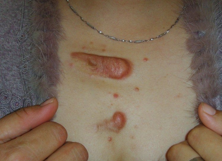 ���ݷ���Ƥ����ҽԺ