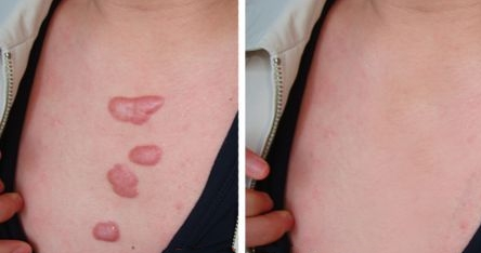 ���ݷ���Ƥ����ҽԺ