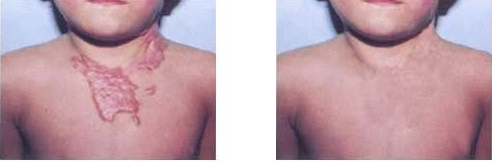 ���ݷ���Ƥ����ҽԺ