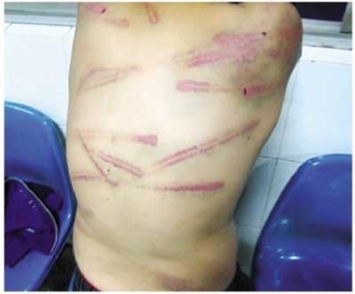 ���ݷ���Ƥ����ҽԺ