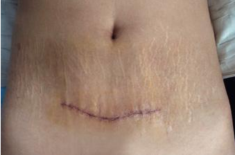 ���ݷ���Ƥ����ҽԺ