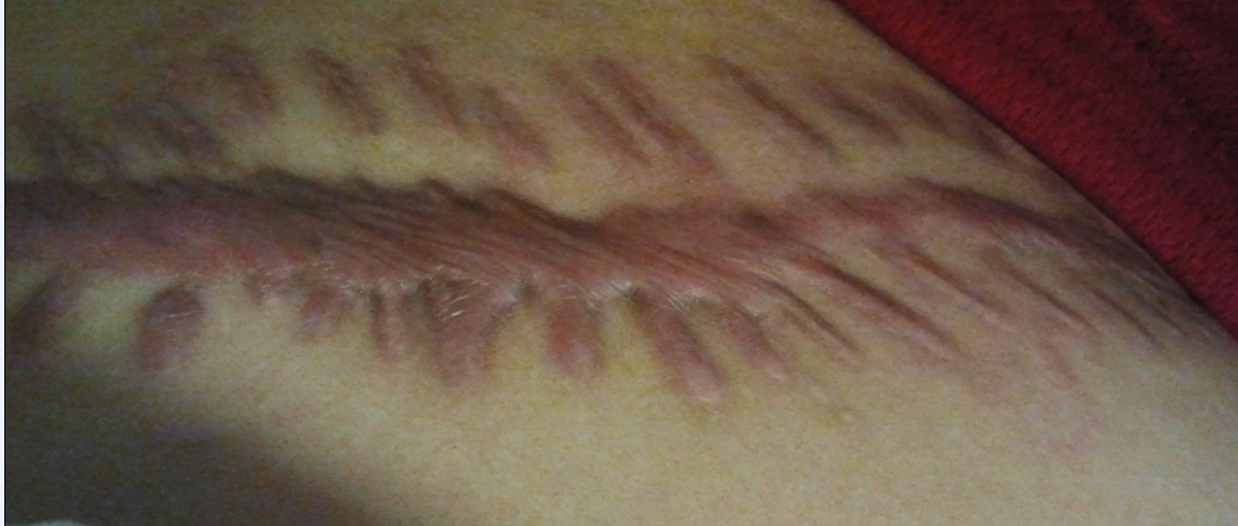 ���ݷ���Ƥ����ҽԺ