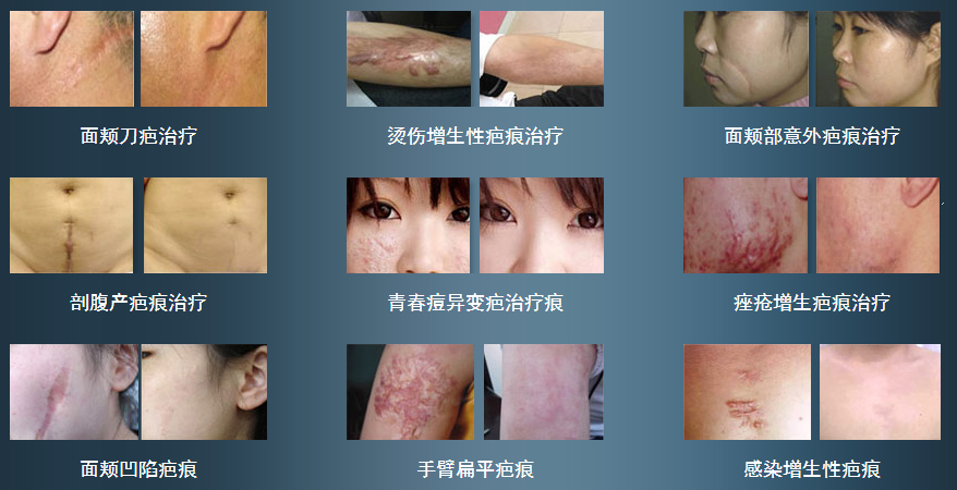 ���ݷ���Ƥ����ҽԺ