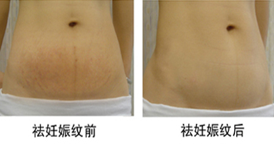 ���ݷ���Ƥ����ҽԺ