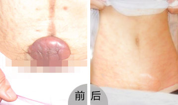 ���ݷ���Ƥ����ҽԺ