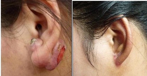 ���ݷ���Ƥ����ҽԺ