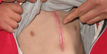 ���ݷ���Ƥ����ҽԺ