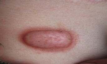 ���ݷ���Ƥ����ҽԺ