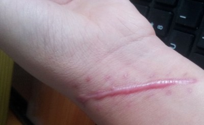 ���ݷ���Ƥ����ҽԺ