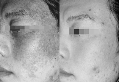 ���ݷ���Ƥ����ҽԺ