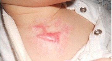 ���ݷ���Ƥ����ҽԺ