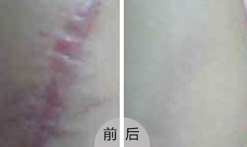 ���ݷ���Ƥ����ҽԺ