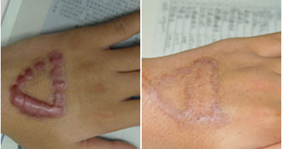 ���ݷ���Ƥ����ҽԺ