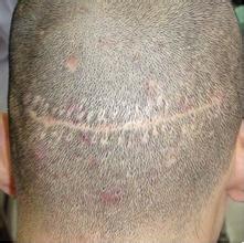 ���ݷ���Ƥ����ҽԺ