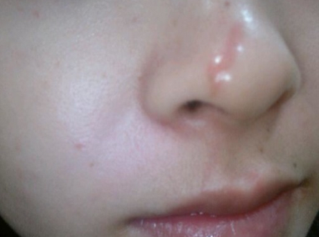 ���ݷ���Ƥ����ҽԺ