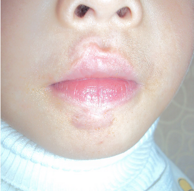 ���ݷ���Ƥ����ҽԺ