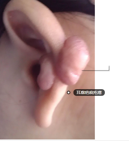 ���ݷ���Ƥ����ҽԺ