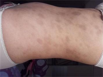 ���ݷ���Ƥ����ҽԺ