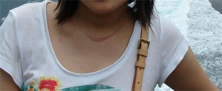 ���ݷ���Ƥ����ҽԺ