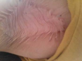 ���ݷ���Ƥ����ҽԺ