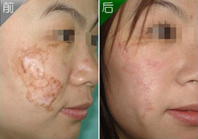 ���ݷ���Ƥ����ҽԺ