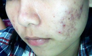 ���ݷ���Ƥ����ҽԺ