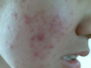 ���ݷ���Ƥ����ҽԺ