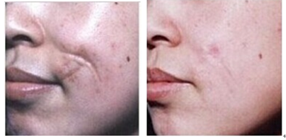 ���ݷ���Ƥ����ҽԺ