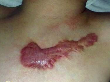 ���ݷ���Ƥ����ҽԺ