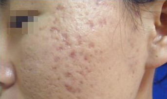 ���ݷ���Ƥ����ҽԺ