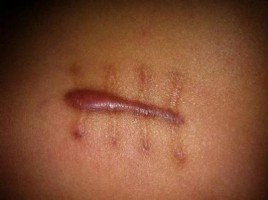 ���ݷ���Ƥ����ҽԺ