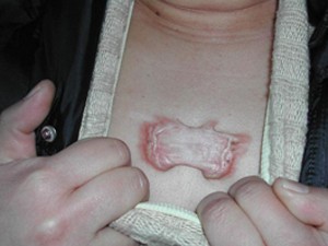 ���ݷ���Ƥ����ҽԺ