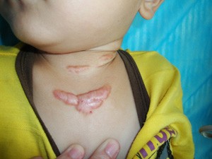 ���ݷ���Ƥ����ҽԺ