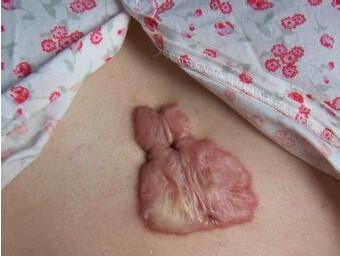 ���ݷ���Ƥ����ҽԺ