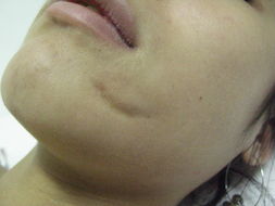 ���ݷ���Ƥ����ҽԺ