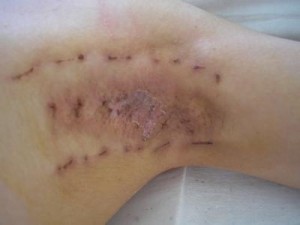 ���ݷ���Ƥ����ҽԺ