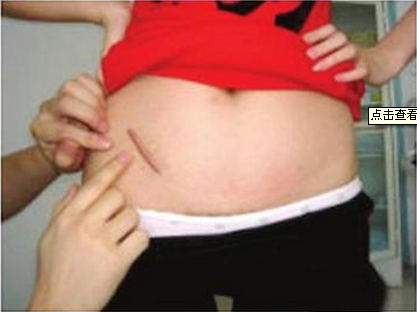 ���ݷ���Ƥ����ҽԺ